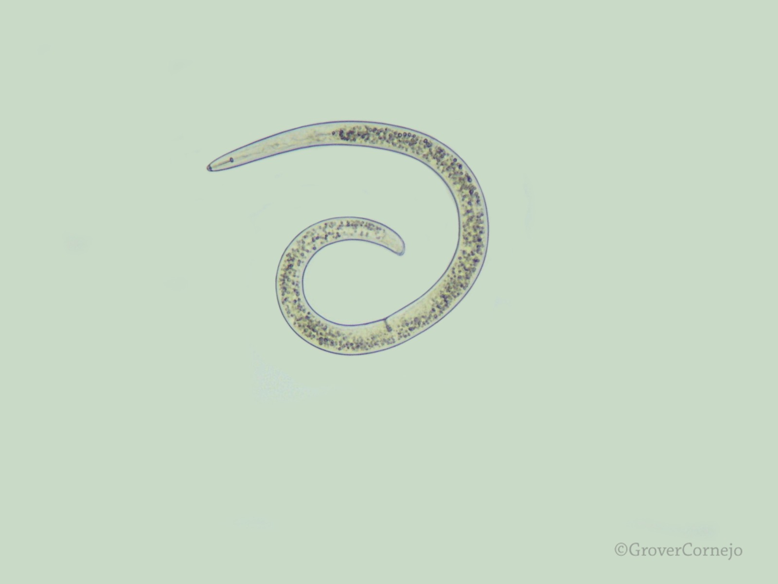 Microscopic Analysis